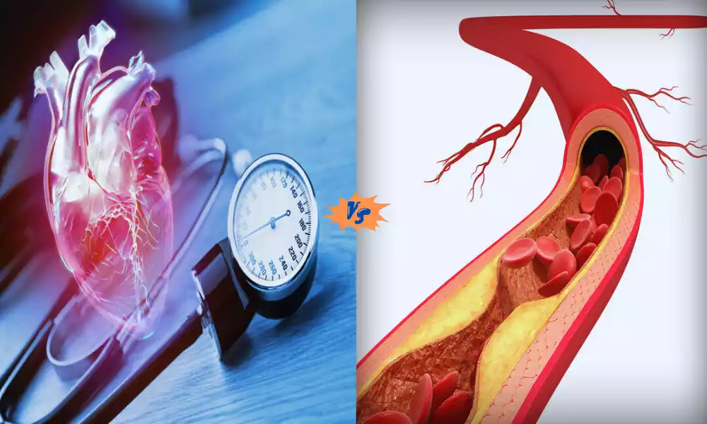 Hypertension and Atherosclerosis