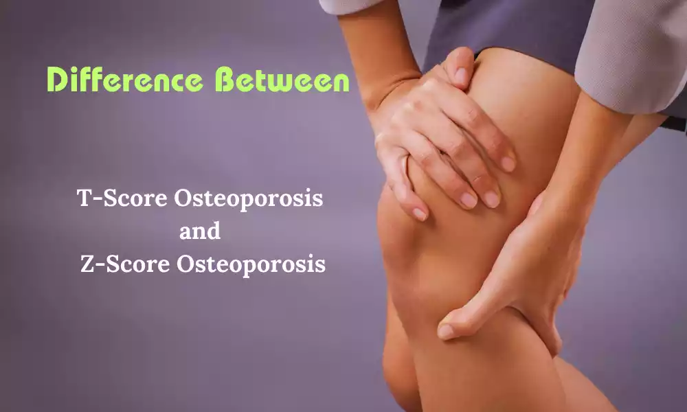T-Score and Z-Score Osteoporosis