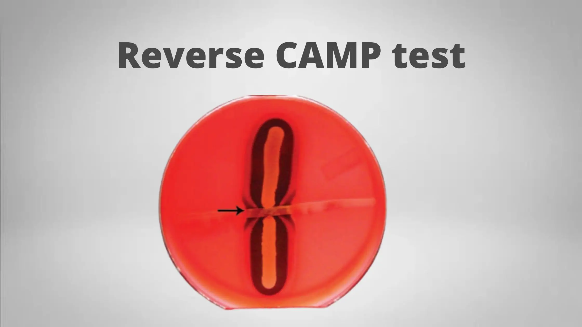 What is Reverse CAMP Test?