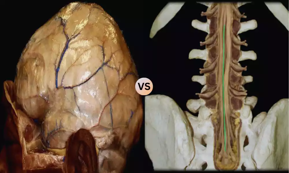 Cranial Dura and Spinal Dura