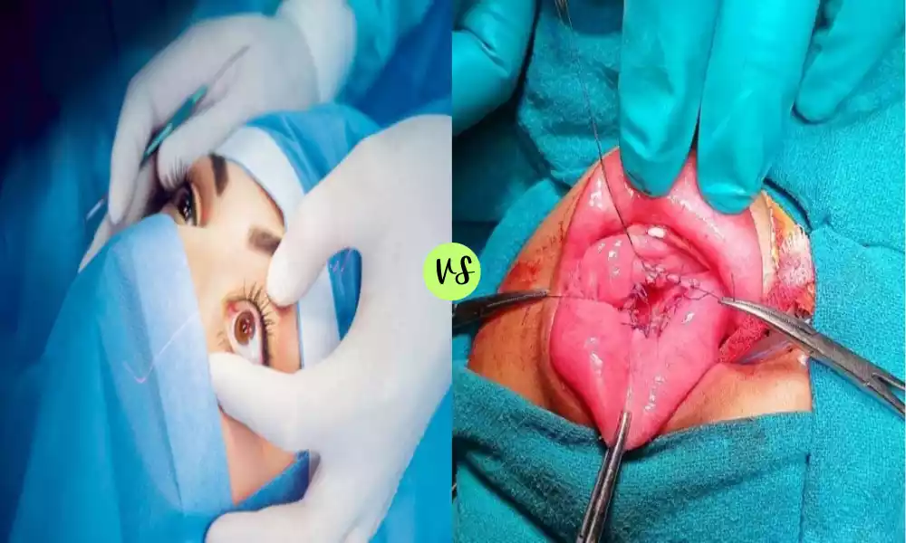Enucleation and Marsupialization