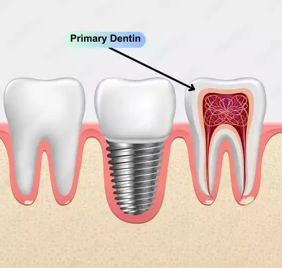 Primary Dentin