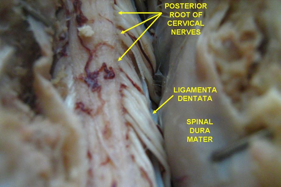 Spinal Dura