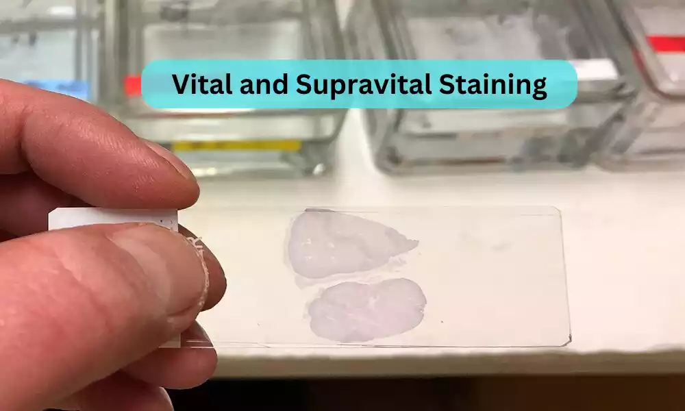 Vital and Supravital Staining