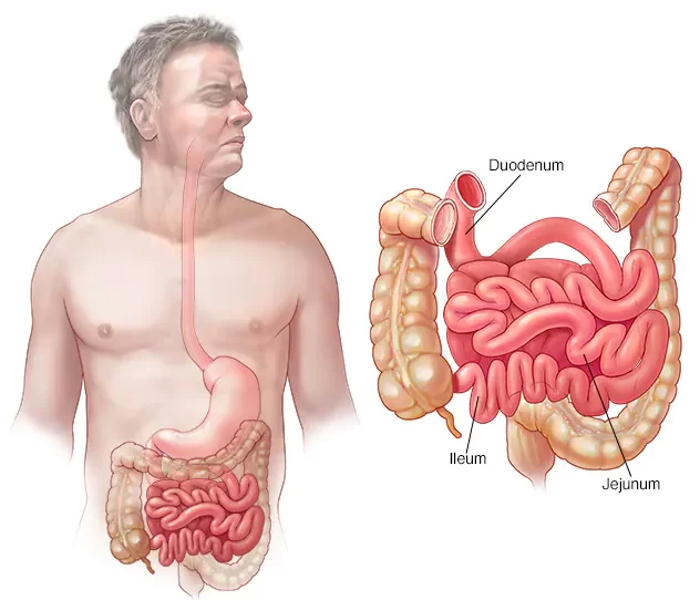 Importance of the difference between Duodenum and Jejunum