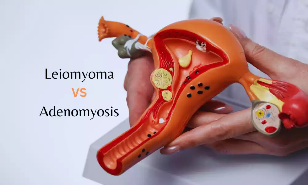 Leiomyoma and Adenomyosis