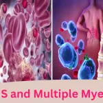 MGUS and Multiple Myeloma