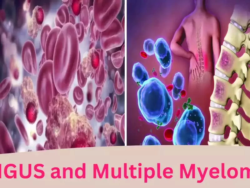 MGUS and Multiple Myeloma